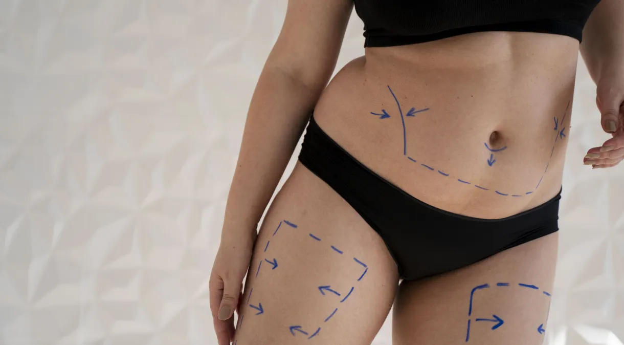 Brasil é o país com maior interesse de busca por lipoaspiração no mundo