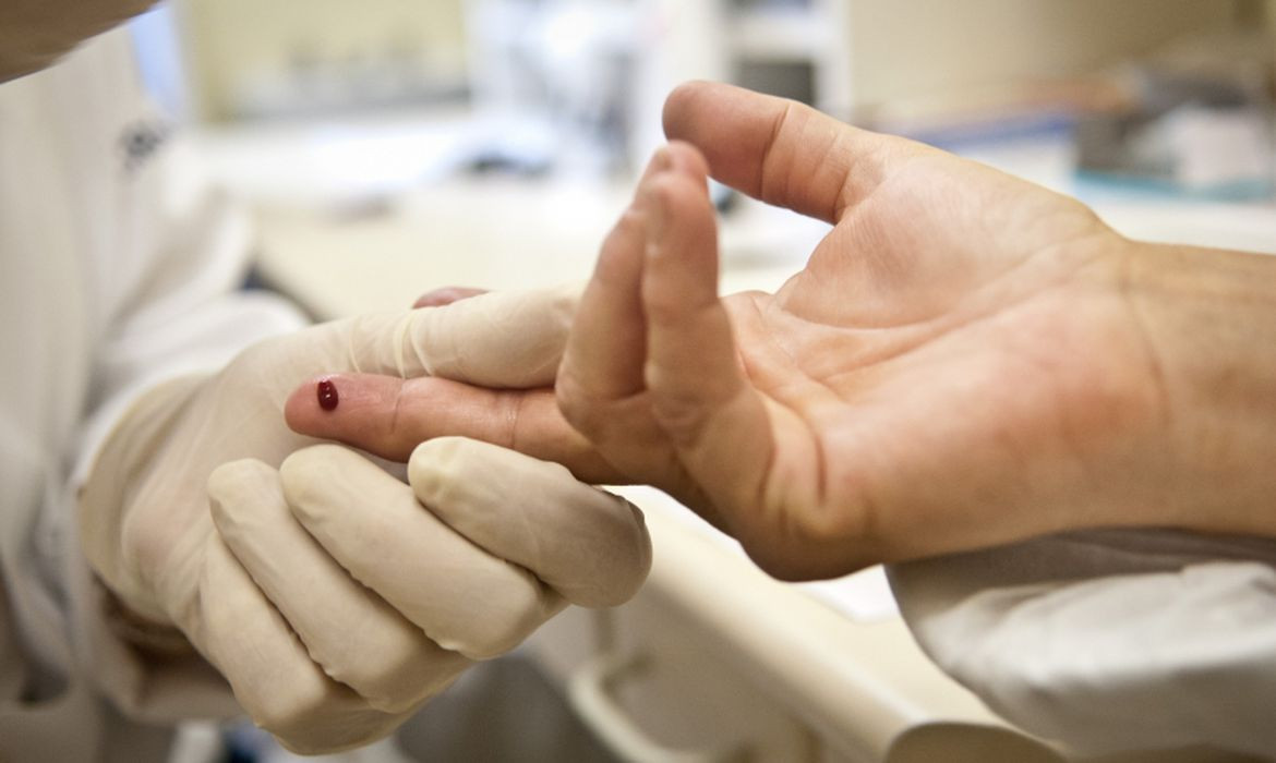 Casos de sífilis e de HIV/aids aumentam entre homens jovens